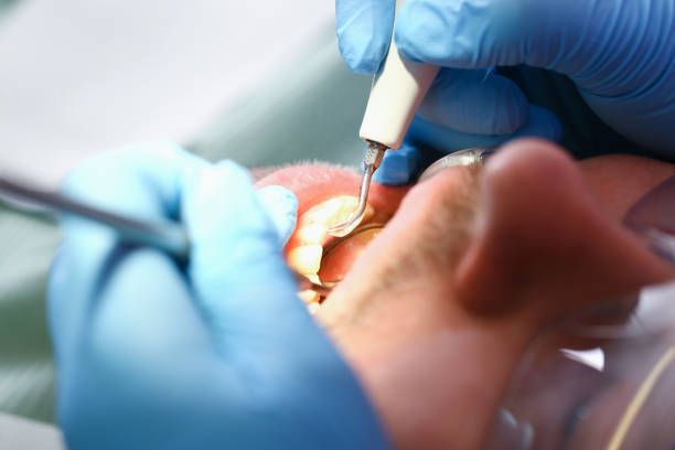  Richton Park, IL Emergency Dentist Pros