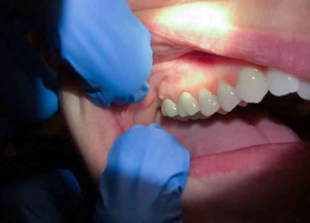 Best Emergency Dental Services Near Me  in Richton Park, IL